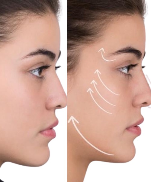 Diplomado en Armonización Orofacial - Instituto ILES Paraguay